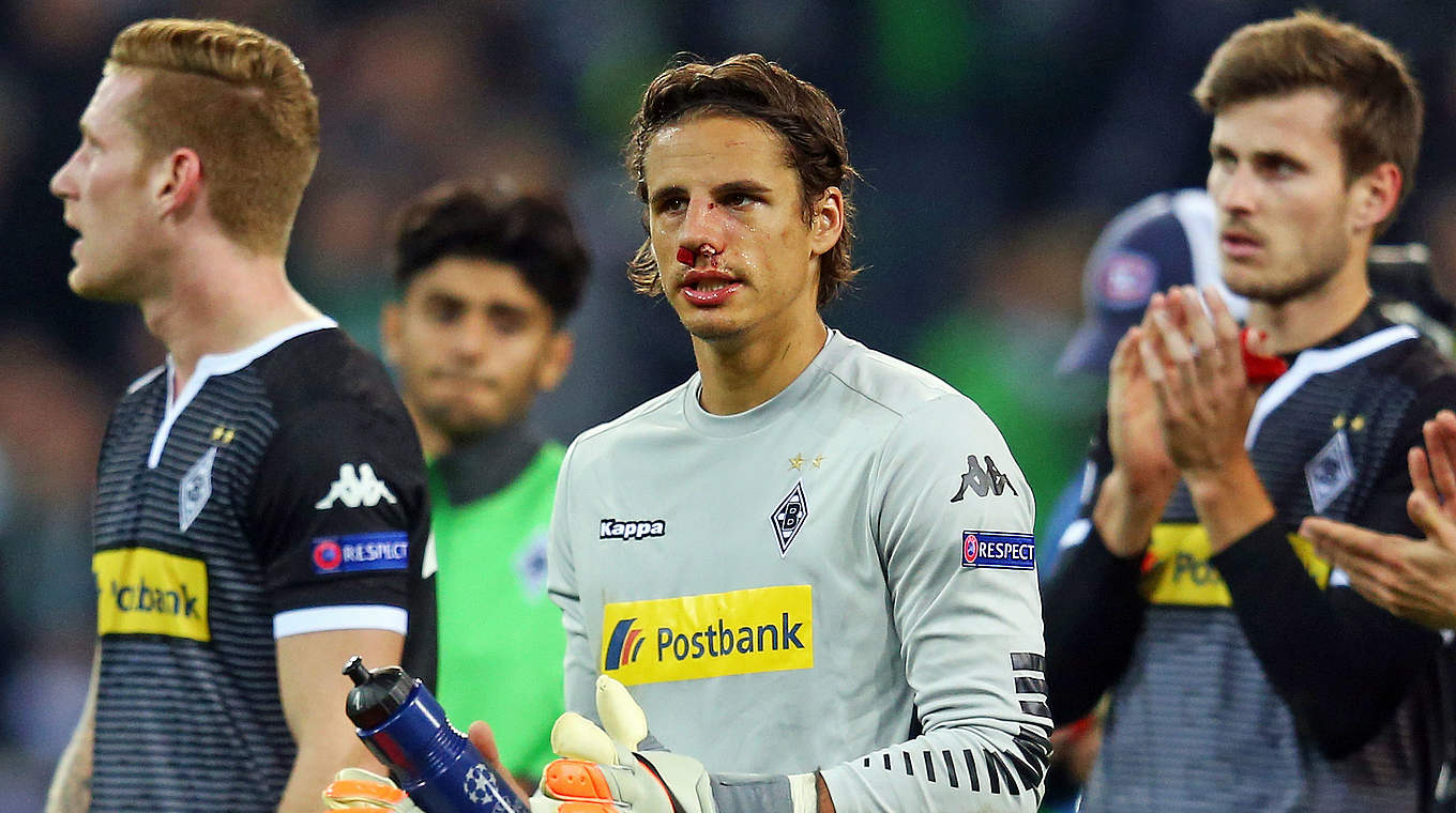 Fällt aus: Yann Sommer mit einem Nasenbeinbruch © 2015 Getty Images