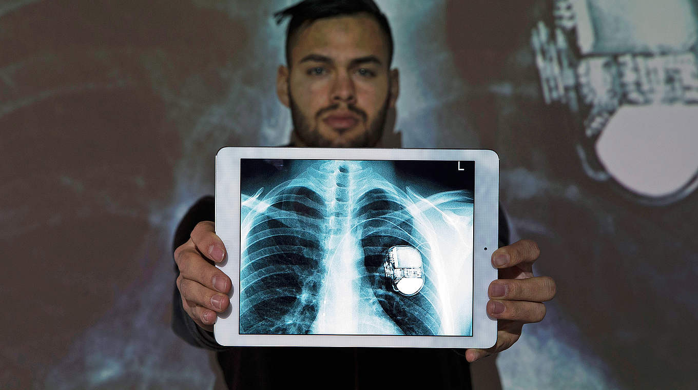 Der erste deutsche Fußballprofi mit im Brustkorb eingebauten Defibrillator: Engelbrecht © 2014 Getty Images