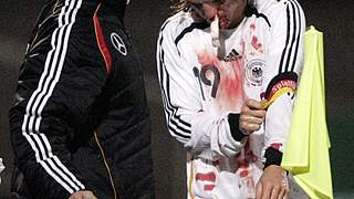 Der verletzte Eugen Polanski ©  Bongarts/GettyImages